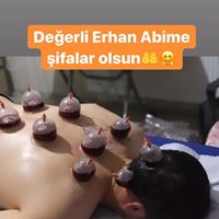 TAYFUR ÇAĞLAYAN HACAMAT Yüreğirde Hacamat Yapanlar