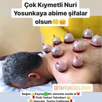 TAYFUR ÇAĞLAYAN HACAMAT Yüreğirde Hacamat Yapanlar