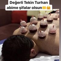 TAYFUR ÇAĞLAYAN HACAMAT Yüreğirde Hacamat Yapanlar