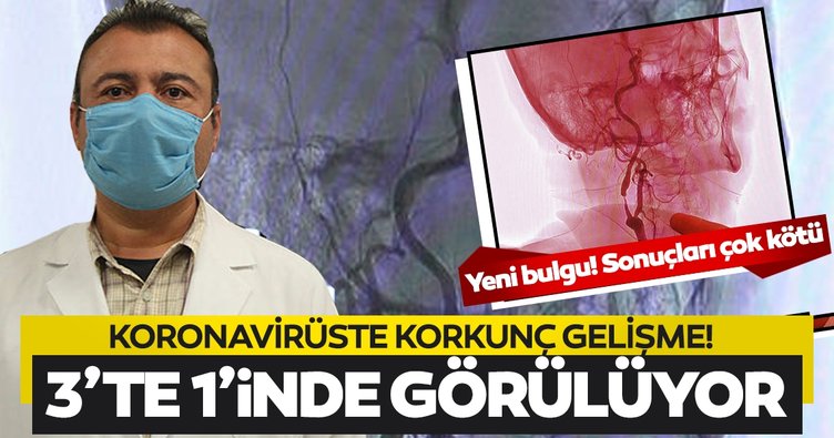 KORONADA KORKUNÇ GELİŞME